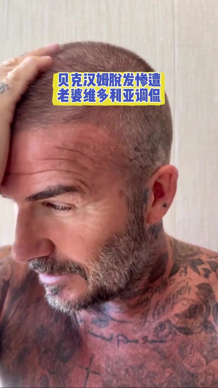 小贝也有中年危机贝克汉姆脱发惨遭老婆维多利亚调侃