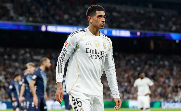 阿斯：皇马对贝林被肘后裁判未看回放感到愤怒，认为标准不一